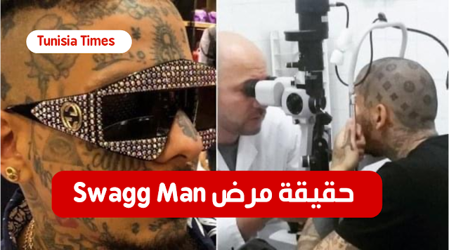 بالصور: حقيقة swaggman.. سواغ مان يكشف عن مرضه النادر و سر إرتدائه نظارات سوداء