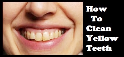 How To Clean Yellow Teeth