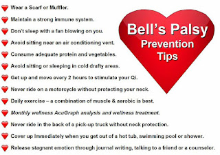 Apa itu Bell Palsy dan bagaimana mencegahnya berulang 