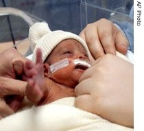 premature baby born tiny