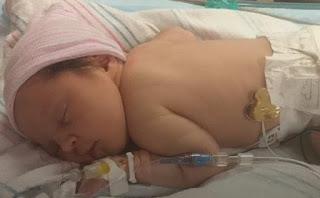 Baby Adrielle came into the world during Hurricane Harvey at Texas Children's Hospital. 