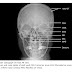 X-Rays of Head & Neck