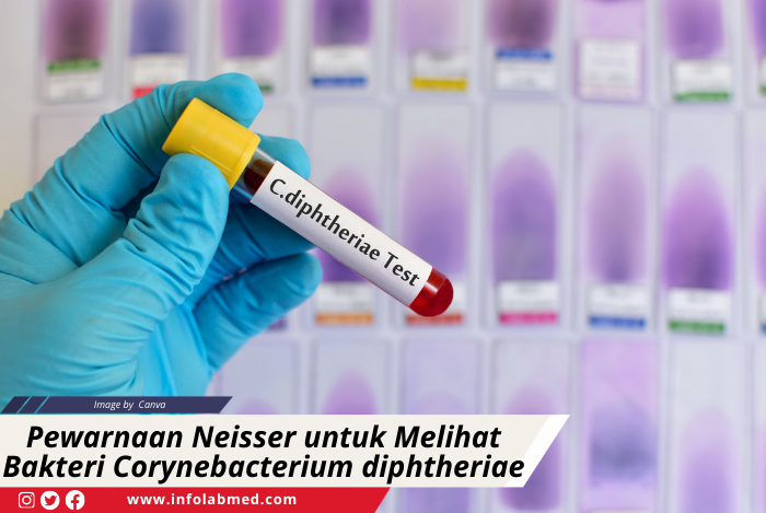Pewarnaan Neisser untuk Melihat Bakteri Corynebacterium diphtheriae