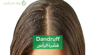 Dandruff