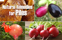 Herbal Remedies To Treat Hemorrhoids And Reduce Piles Pain At Home