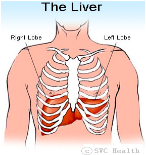 Hepatitis A: Symptoms, treatment and prevention