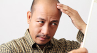  What Causes Male Pattern Baldness?