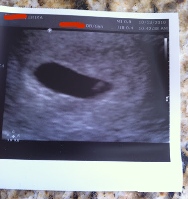 ultrasounds at 6 weeks. ultrasounds at 6 weeks.