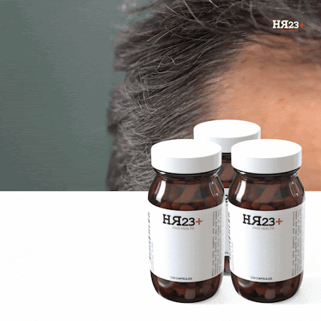 hair growth supplement for receding hairline