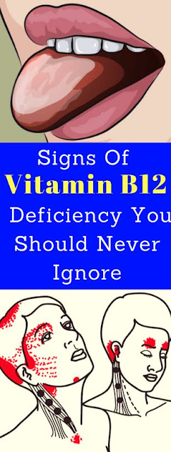 Signs Of Vitamin B12 Deficiency You Should Never Ignore