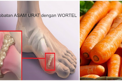 "Sangat Ampuh" Dalam Hitungan Jam Asam Urat Bisa Normal Lagi Hanya Dengan Wortel..Ikuti Caranya Disini..!!