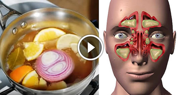They Call It The Bomb The Remedy To Remove Nasal Congestion, Sinusitis And Flu In 1 Day