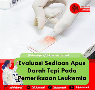 Evaluasi Sediaan Apus Darah Tepi Pada Pemeriksaan Leukemia