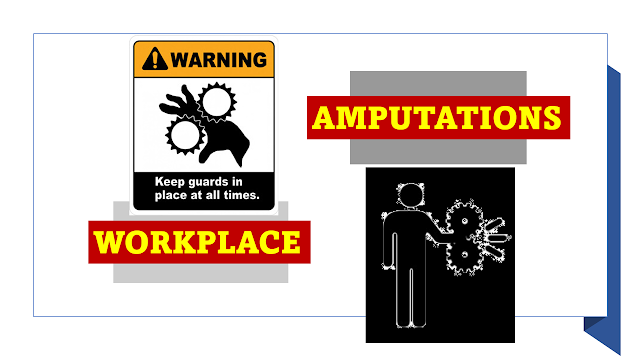 Sources of Amputations in the Workplace