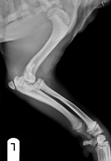 fractura proceso lateral codo