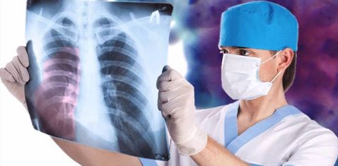 What Is Malignant Mesothelioma?