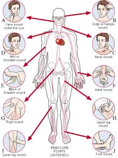 Penjelasan Lengkap Cara Mengatasi Perdarahan dengan Metode T.E.T