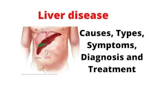 What Is Liver Disease