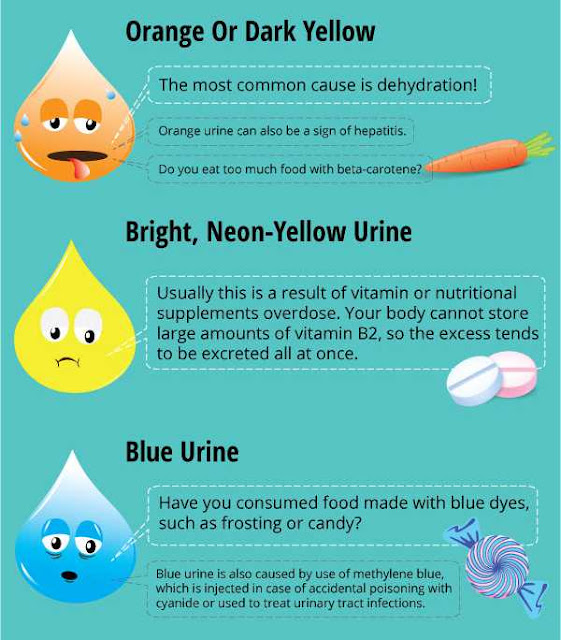 Kenapa Air Kencing Berwarna Kuning Terang Bila Makan B 