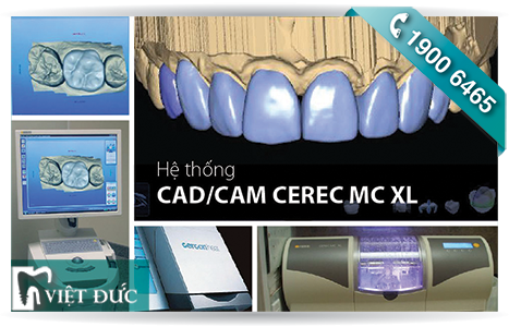 Công nghệ CAD/CAM hỗ trợ quá trình bọc răng sứ chính xác đến từng vi điểm ở mọi mặt răng và rút ngắn thời gian bọc sứ xuống chỉ còn từ 1 - 3 ngày