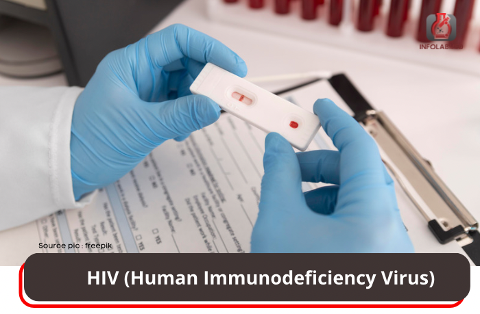 HIV (Human Immunodeficiency Virus)