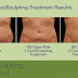 Does Coolsculpting Really Work?