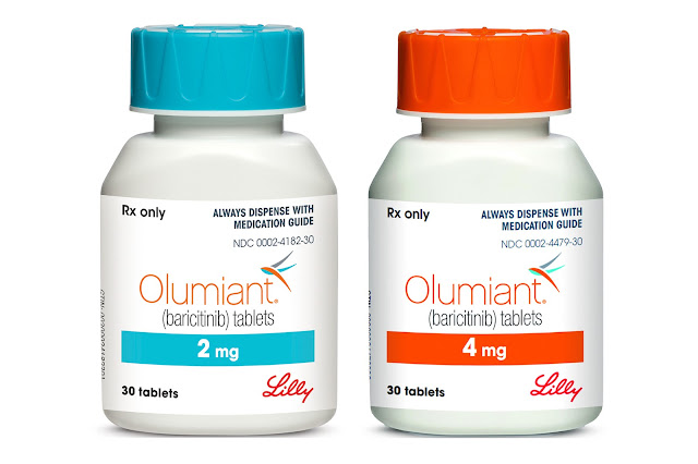 Olumiant for Alopecia Areata