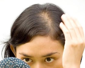 10 Home Remedies for Hair Fall