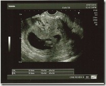 Sonogram 7-7-10