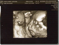 ultrasound 10-27-10(4)