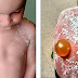 Find out what caused these kids horrifying injuries! 