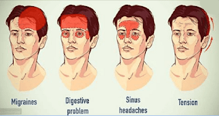 17 Types Of Headaches