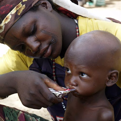 Pobreza extrema en África (hambruna y desnutrición)