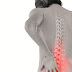 11 Resep Ampuh Atasi Osteoporosis