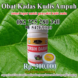 obat gatal kadas kudis