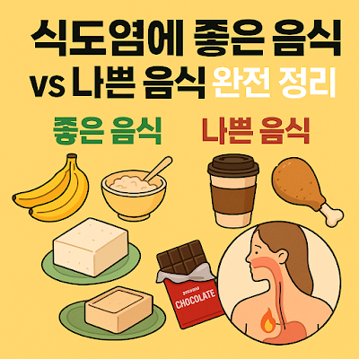 식도염 음식 가이드 – 먹으면 낫는 음식 vs 더 아픈 음식 총정리!