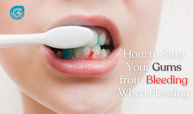 How to Stop Your Gums from Bleeding When Flossing