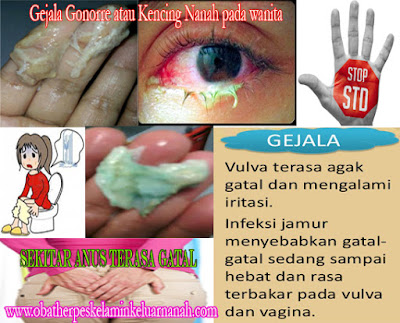 Obat kencing nanah