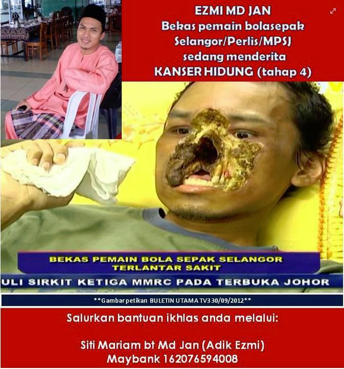 HIDUP MESTI DITERUSKAN: BARAH HIDUNG - LEBIH DAHSYAT 