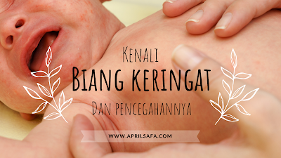 kenali biang keringat dan pencegahannya