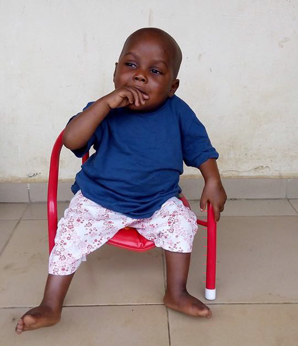 2-Year-Old ‘Witch Child’ Who Was Left To Die Makes Stunning Recovery - Now look at him just 8 weeks later