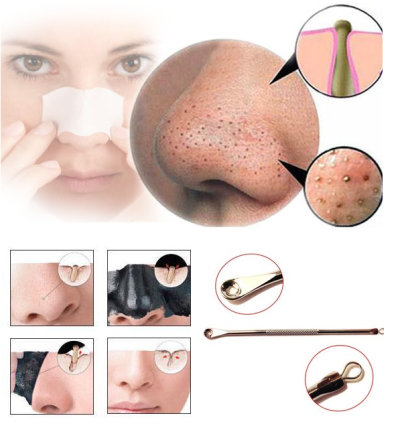 Badan Sihat Hati Ceria: Cara Mudah Hilangkan Blackhead dan 