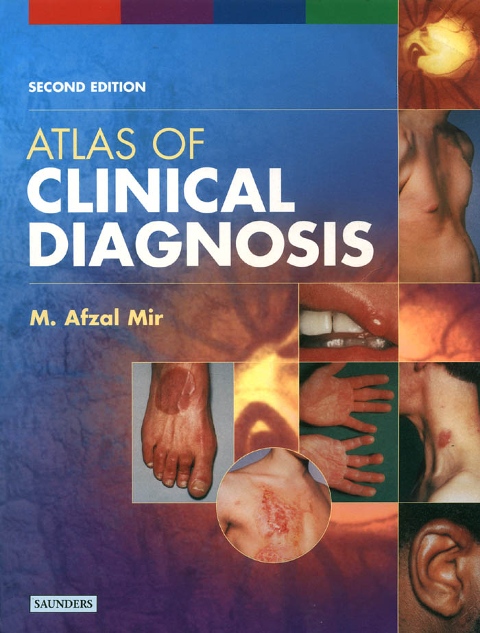 Atlas of Clinical Diagnosis - Free Ebook - 1001 Tutorial & Free Download