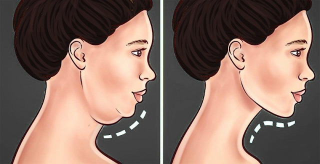 Best Exercises To Get Rid Of Double Chin And Neck Fat (VIDEO)