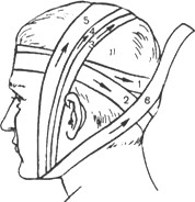 Наложение бинтовых повязок на голову