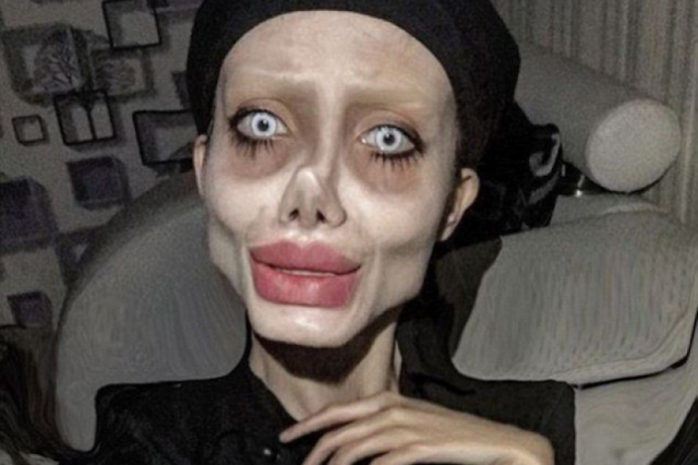 WANITA yang melakukan puluhan pembedahan plastik gara-gara mahu kelihatan seperti aktres Angelina Jolie, dimasukkan ke hospital kerana dijangkiti koronavirus atau Covid-19.