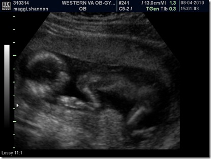 BABY_5