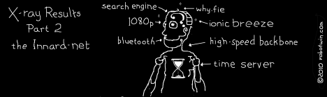 Caption: X-ray Results Part 2 the Innard-net. Diagram of Robotwin: Brain - search engine. Eyes - 1080p. Mouth - bluetooth. Hair - why-fie. Sparks - ionic breeze. Neck - high-speed backbone. Heart (shaped like an hour-glass) - time server.