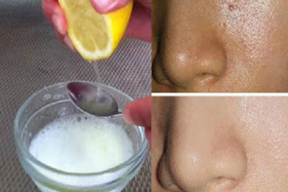 Just By Using 2 Ingredients Your Pores Will Disappear Forever And Your Face Will Be Cleaner Than Ever!