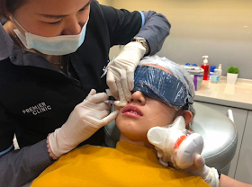 botox filler injection in Malaysia